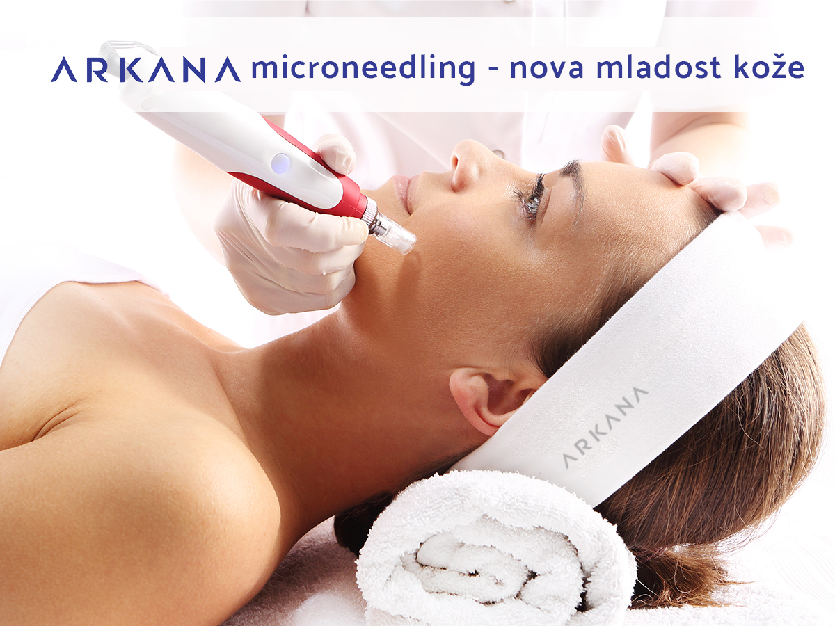 Microneedling